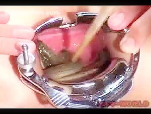 Live eel anal insertion with speculum