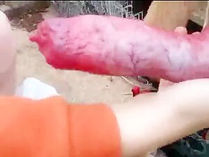 Thumb 2